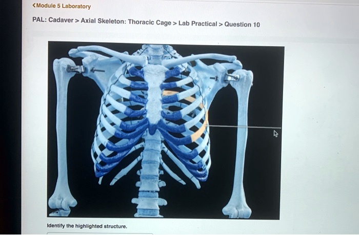 Pal cadaver axial skeleton skull lab practical question 16